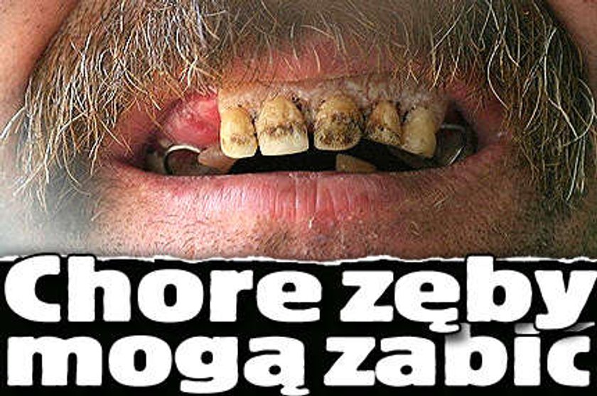 Chore zęby mogą zabić