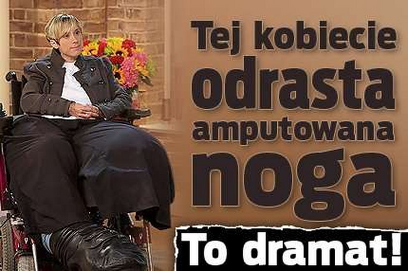 Tej kobiecie odrasta amputowana noga. To dramat!