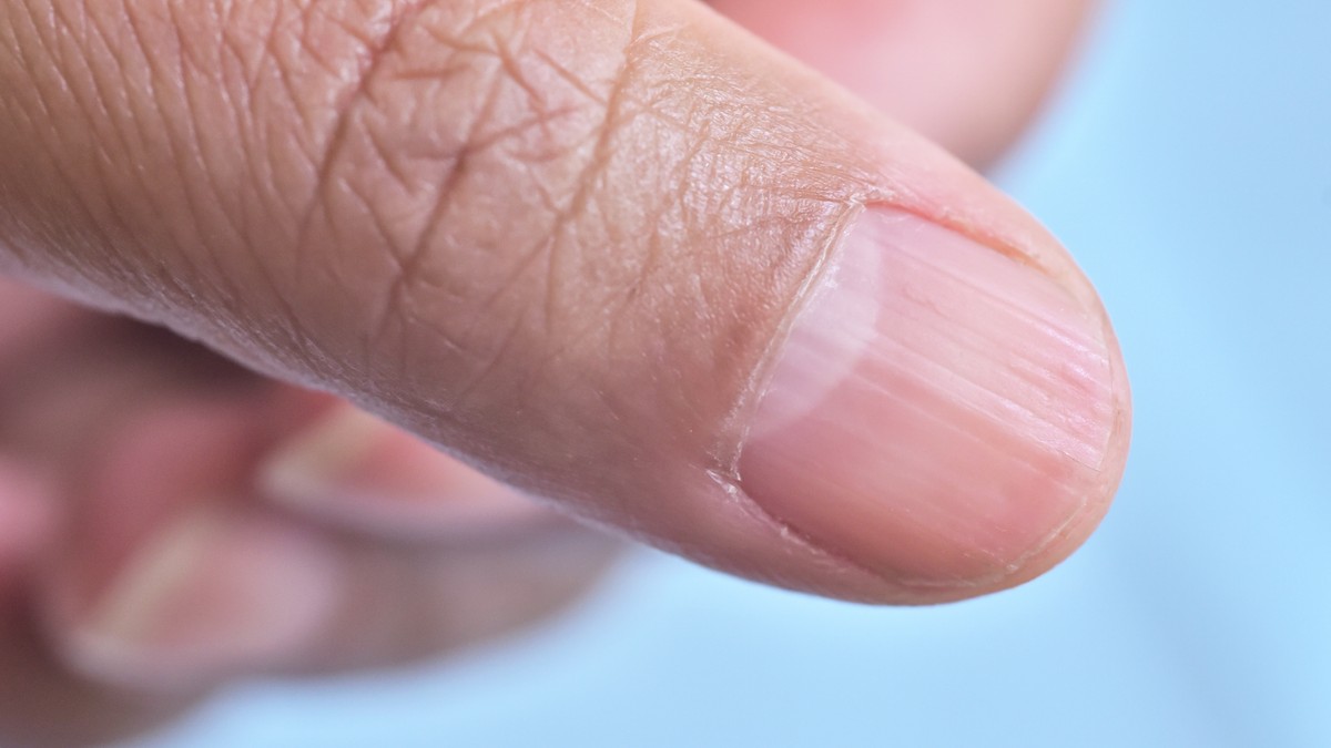 Polumesec na noktima