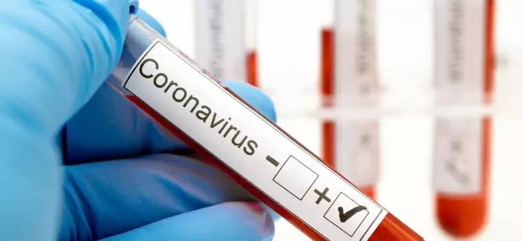 Koronawirus może tkwić w ciele nawet dwa lata, potwierdzają to badania