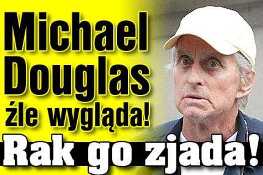 Douglas źle wygląda!