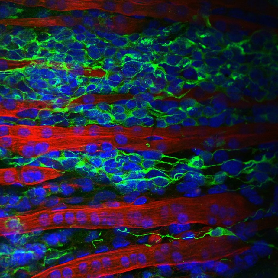 Trzecie miejsce w kategorii Eureka i Odkrycie: "Zaprojektowany w 3D model tkanki in vitro"