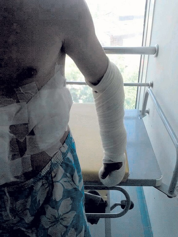 Laza S. uboden je u stomak