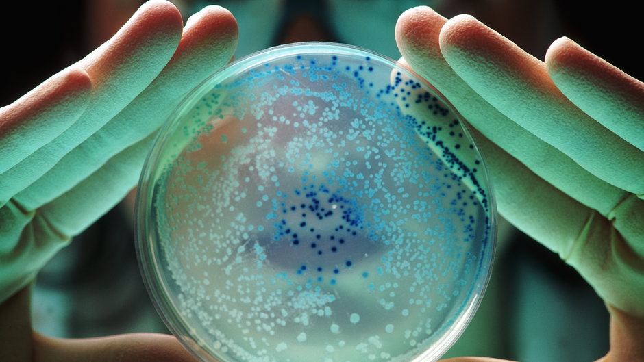 Bakterie namnożone na szalce Petriego z pożywką