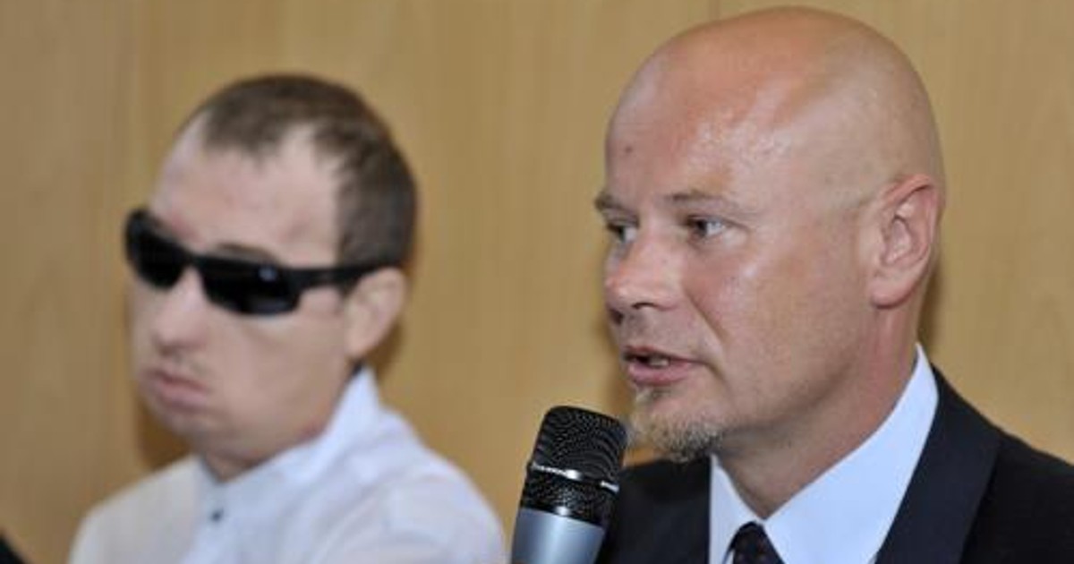 "Medyczny Oscar" trafił w ręce profesora Maciejewskiego za przeszczep twarzy