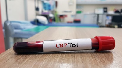 Mit jelent a CRP érték a laborleleten?