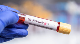 WHO: wykryto przypadek koronawirusa MERS-CoV. Zakażony 28-letni mężczyzna