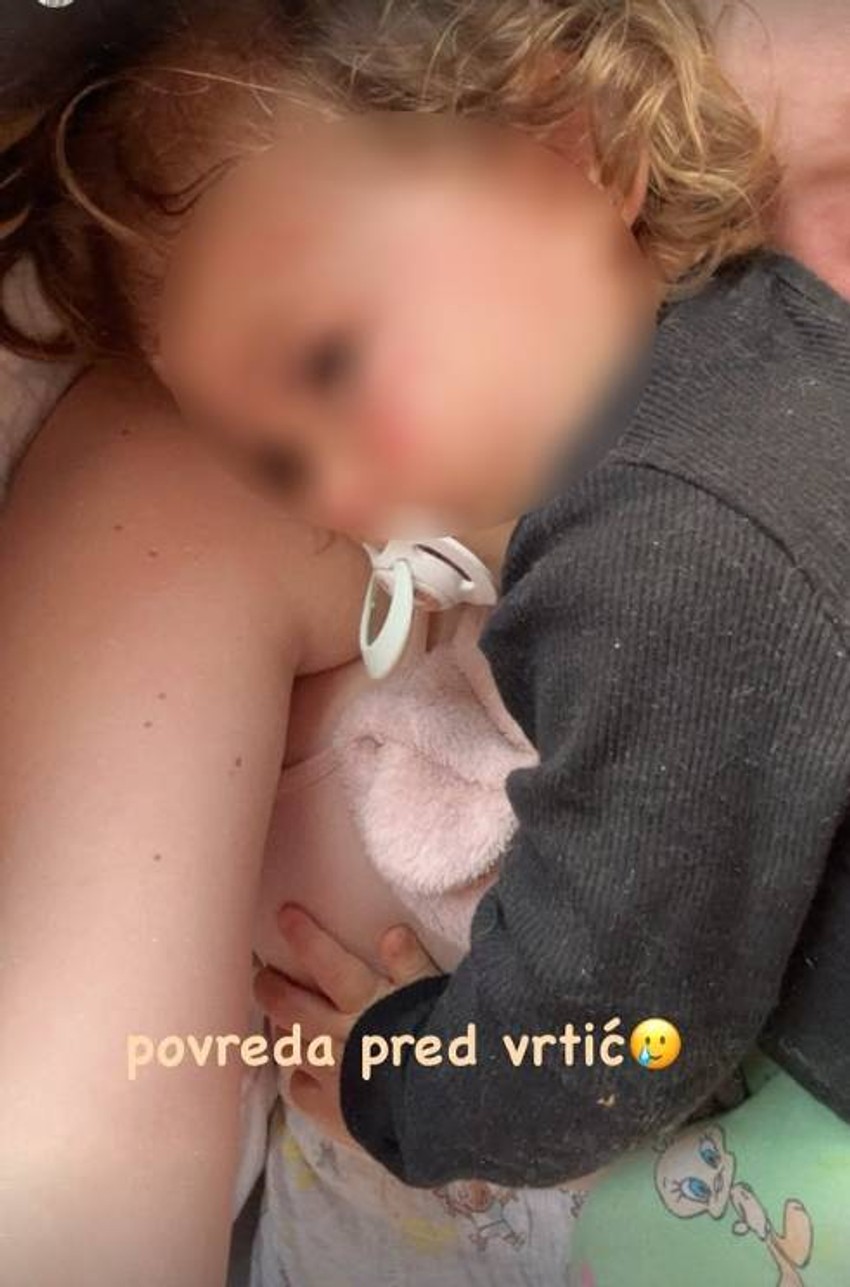 Milica Veličković drži ćerkicu u naručju, mala Barbara sa ogrebotinama na licu: "Povreda pred vrtić"