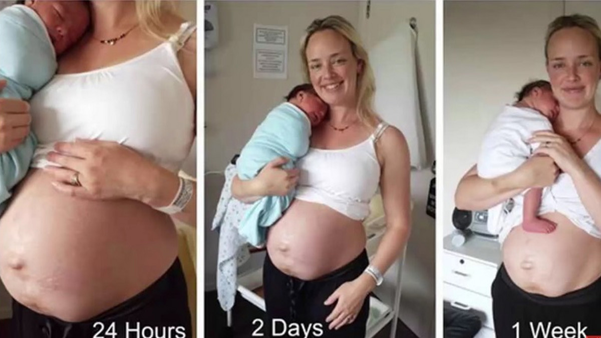 Julie Bhosale to kobieta z Nowej Zelandii, która postanowiła pokazać swoje ciało po urodzeniu drugiego dziecka. Zrobiła zdjęcia po to, by pogodzić się z kompleksami.