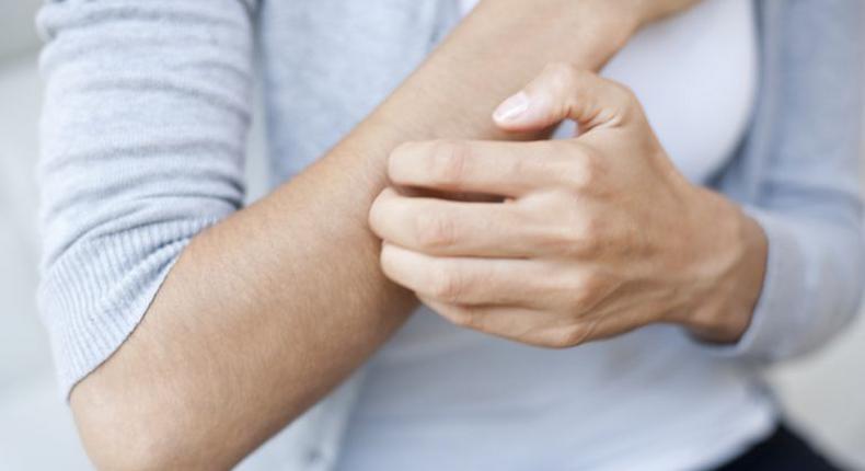 Woman scratching her arm