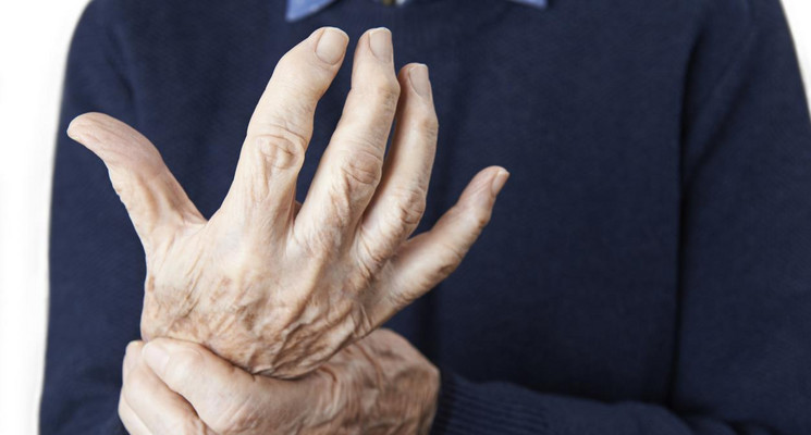 Артрит - это не просто заболевание пожилых людей
