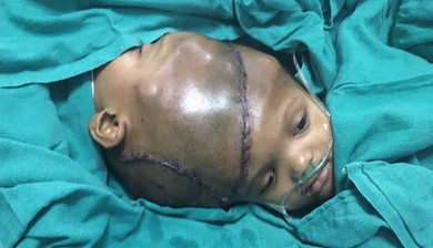 Video: Siamese twins separated at Korle Bu in 1999 turn 19 years