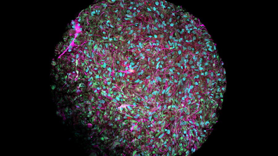 Biokomputery działające w oparciu o komórki ludzkiego mózgu?, fot. Jesse Plotkin/Johns Hopkins University