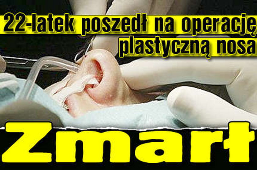 Poszedł na operację plastyczną nosa. Zmarł