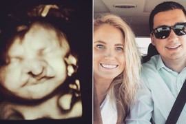 Sari su doktori rekli "ABORTIRAJ" kad su videli ultrazvuk bebe: "NISMO IH POSLUŠALI, naš sin danas ima 8 GODINA I EVO KAKO IZGLEDA"