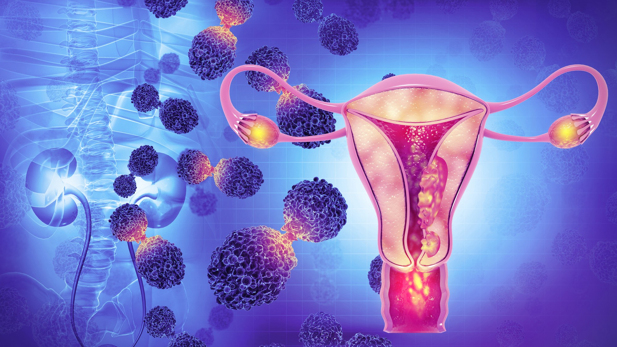 5 gynekologických rakovín, o ktorých by ste mali vedieť: Nie každá sa dá odhaliť preventívnou prehliadkou, aké príznaky treba sledovať?