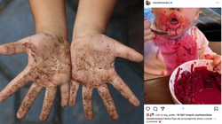 Ola Żebrowska pokazała dzieci oblane zupą. Lekarka: Nie bez powodu mówi się, że...