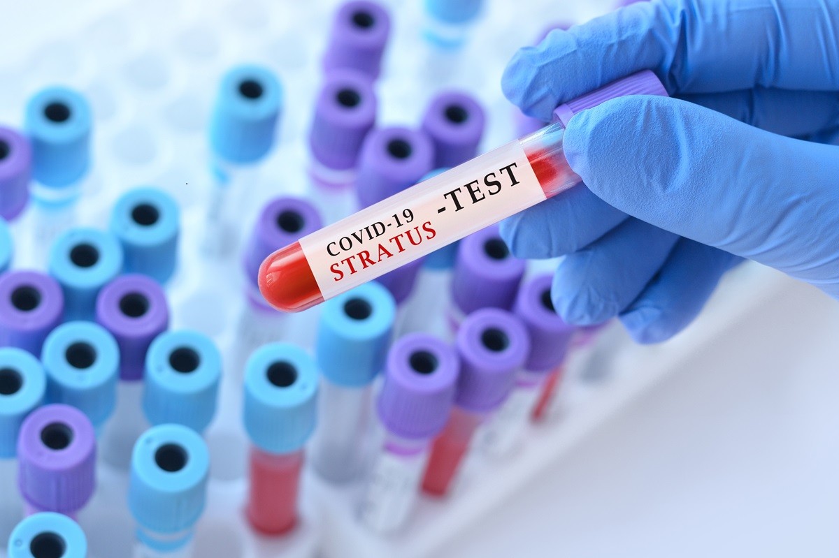 Ręka w niebieskiej rękawiczce trzyma probówkę z etykietą „COVID-19 Status Test” nad stojakiem z innymi probówkami laboratoryjnymi.