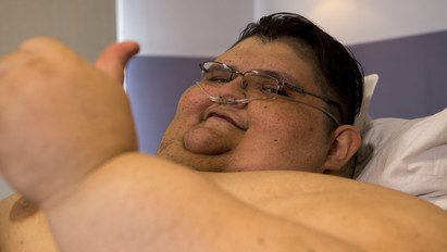 170 kilót fogyott - első lépéseit tenné meg hét év után a világ legkövérebb embere - fotók