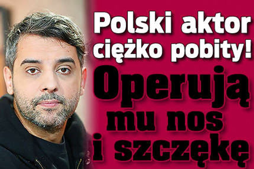 Polski aktor ciężko pobity! Operują mu nos i szczękę