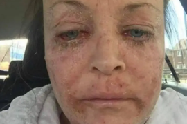 ZAVRŠILA JE PRAVNI FAKULTET, radila u Gradskom veću, a onda je postala OVA ŽENA SA SLIKE: Nakon što su joj roditelji umrli odala se ALKOHOLU, došla pred VRATA HADA, a pogledajte je sad