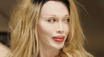 Pete Burns