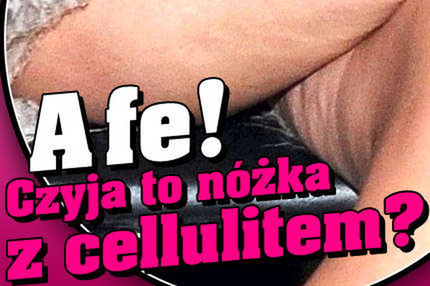 A fe! Czyja to nóżka z cellulitem?