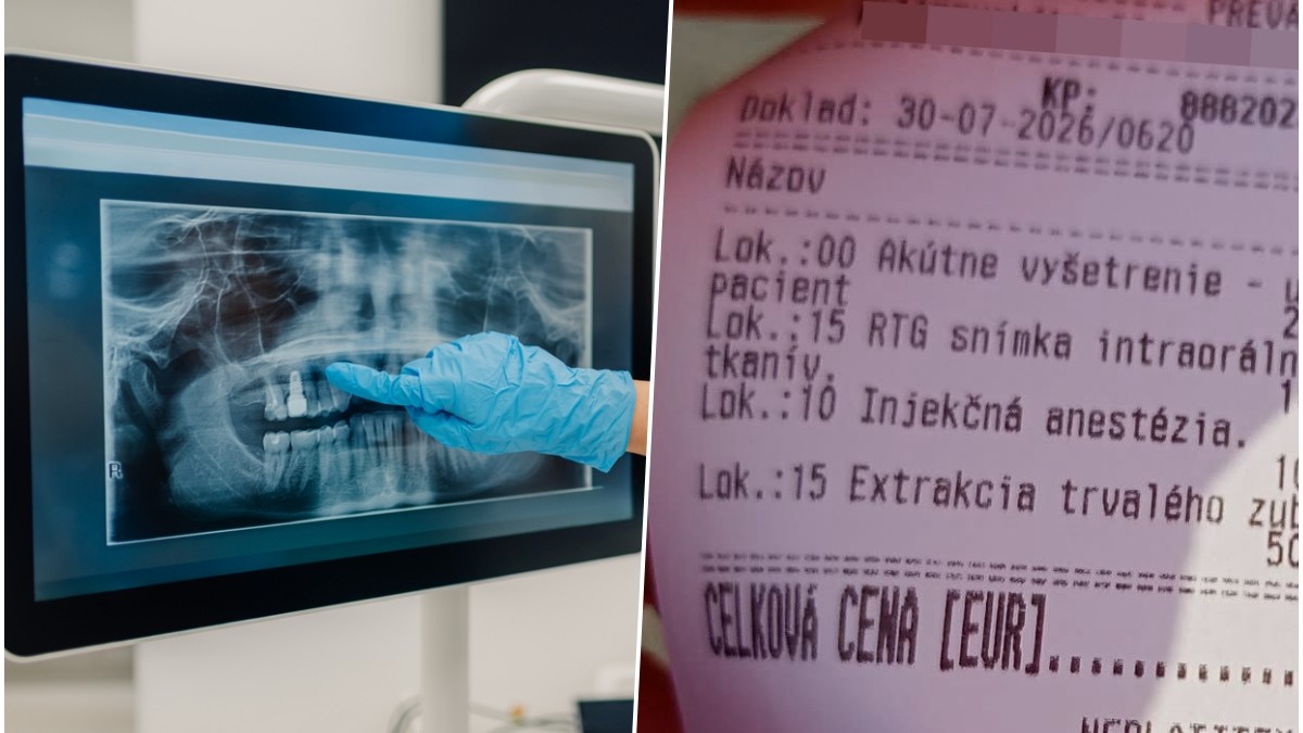 Slovákov rozhneval účet za trhanie zuba. 