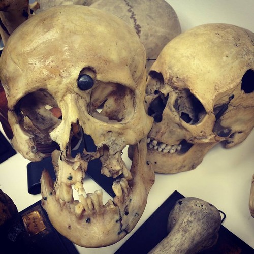 Eksponat z Mütter Museum