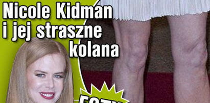 Nicole Kidman i jej straszne kolana. FOTY