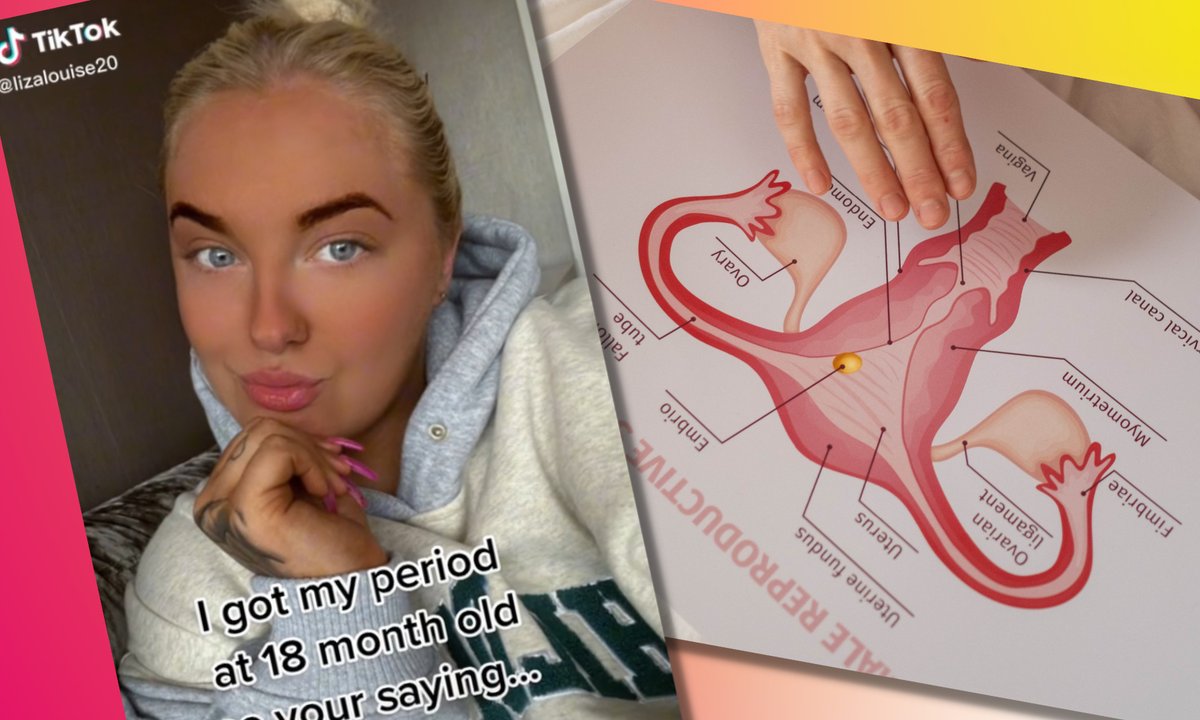 Zaczęła miesiączkować, gdy miała 18 miesięcy. "Rodzice byli przerażeni"