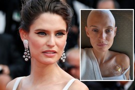 NAJPRIVLAČNIJA ŽENA NA PLANETI hrabro se bori sa RAKOM JAJNIKA: Ovo je JEDINI SIMPTOM koji je osetila