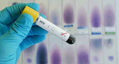 Alarmujące dane o wzroście zakażeń HIV w Polsce. Podwojona liczba nowych zakażeń to efekt pandemii? 2022 roku przyniesie nowy rekord