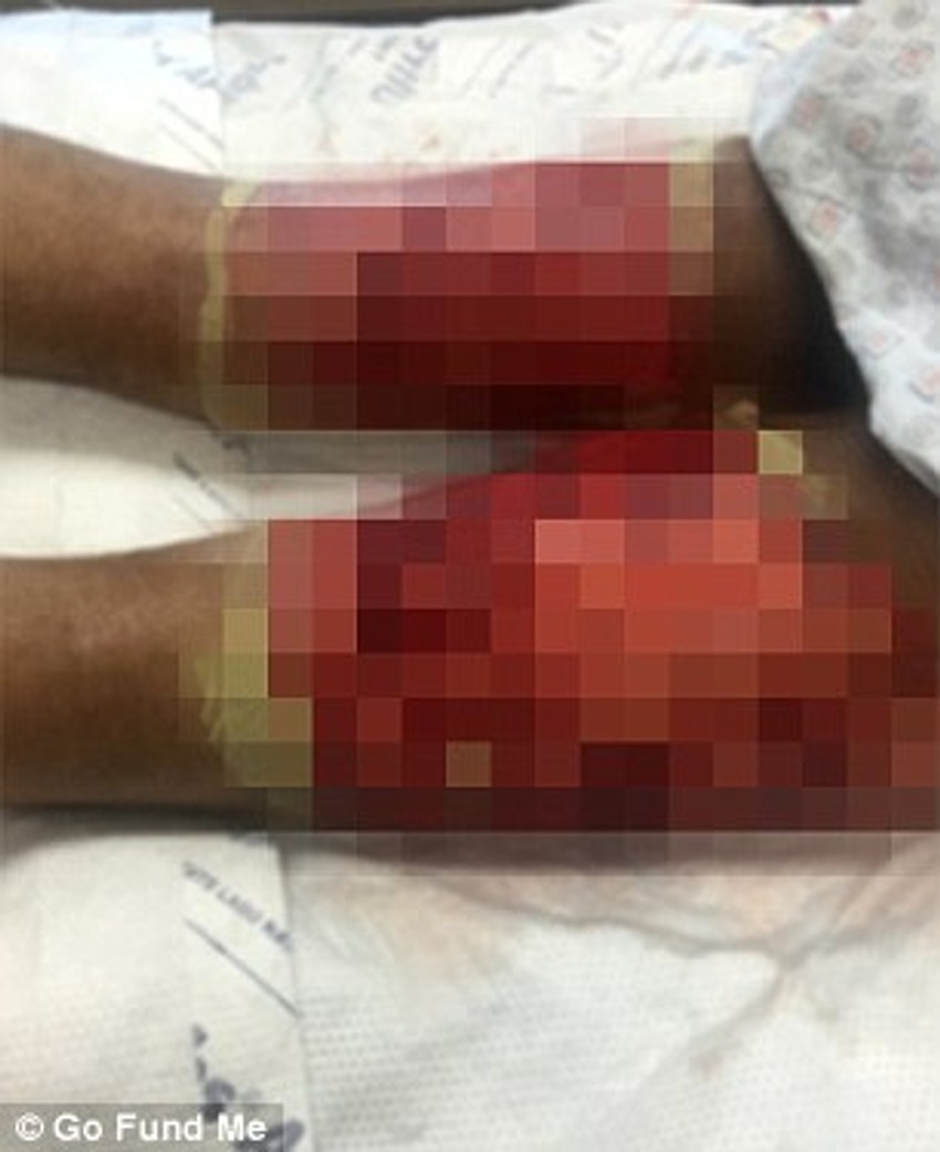 Tolbertove povrede zbog kojih je završio u komi