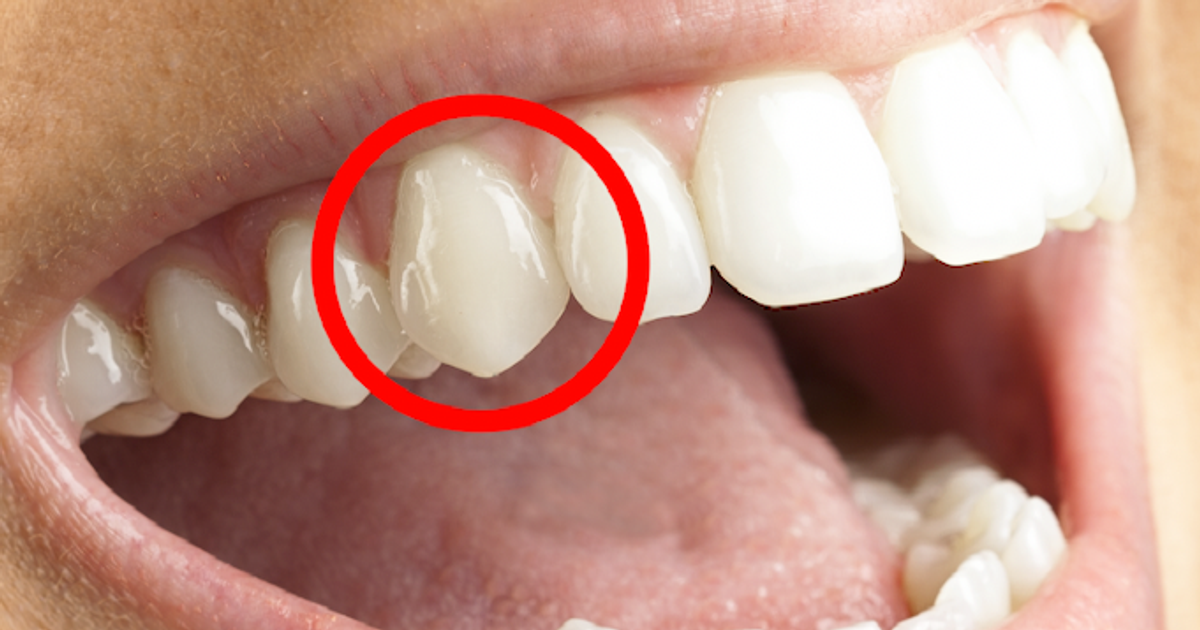 The reason humans have sharp front teeth isn't for tearing meat Pulse