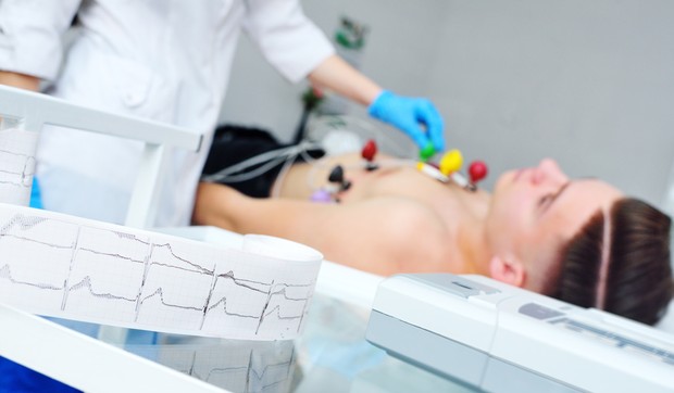 Ekg 
