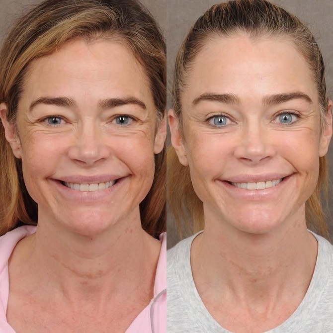 Transformacija Deniz Ričards