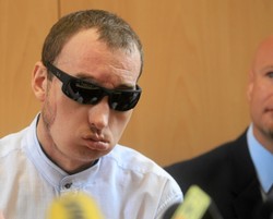 Pionierska operacja udała się doskonale. Pacjent po przeszczepie twarzy: Dziękuję