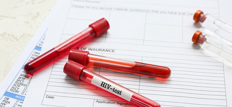 Cicha epidemia. W Polsce co trzeci zakażony wirusem HIV o tym nie wie