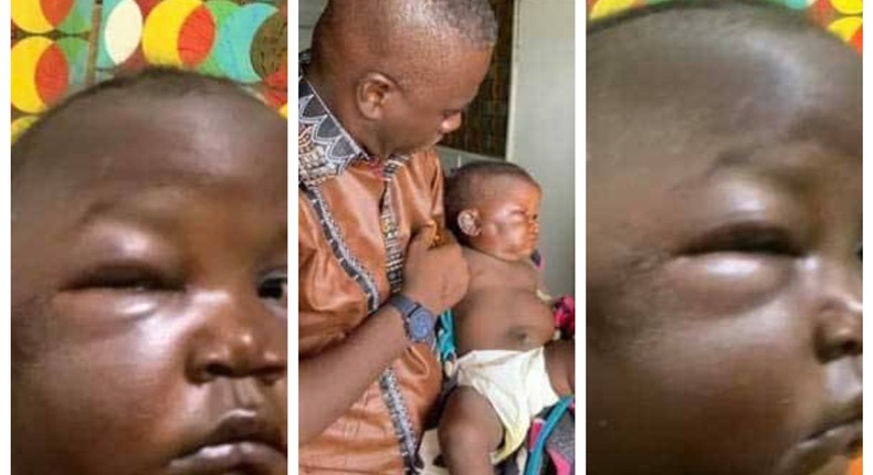 Heartless father brutalises 1-year-old daughter out of anger