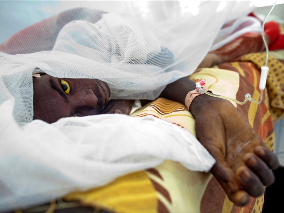 Saleh Mohammed Hamid, 18, from West Darfur's Gocker, is treated at Teaching Hospital after getting infected with yellow fever.