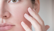 Przebarwienia na twarzy — przyczyny, rodzaje, profilaktyka, domowe sposoby