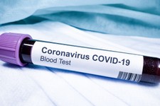 Turyści kupowali fałszywe zaświadczenia o negatywnym wyniku testu na Covid-19