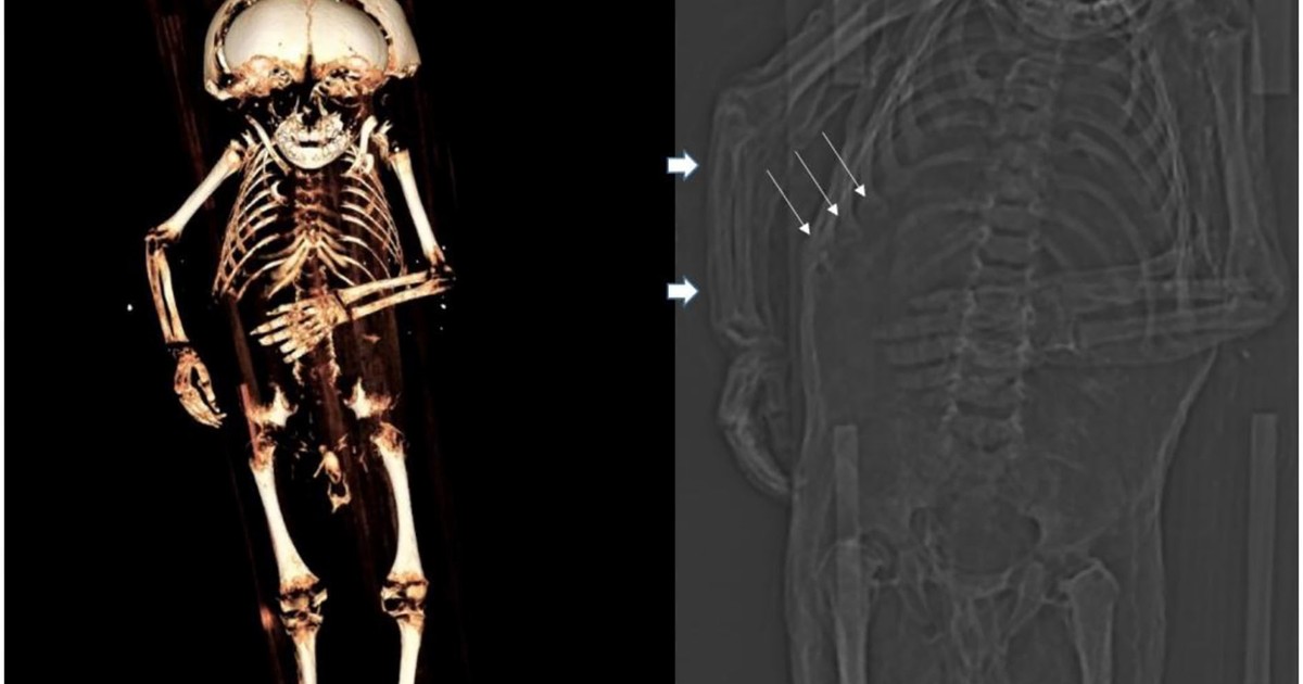 Bez słońca, zabawy, ruchu. Na zamkach i dworach hodowano kalekie dzieci