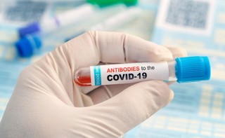 W Rosji najwyższy od wybuchu epidemii dobowy przyrost zakażeń i zgonów na COVID-19