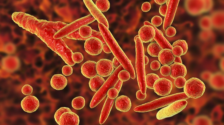 fertőzés kína tüdőgyulladás Mycoplasma pneumoniae