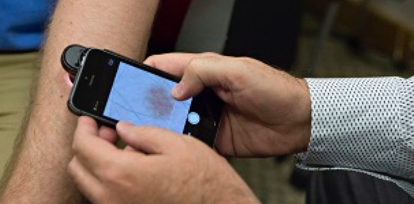Aplikacja na smartfony potrafi wykryć raka skóry