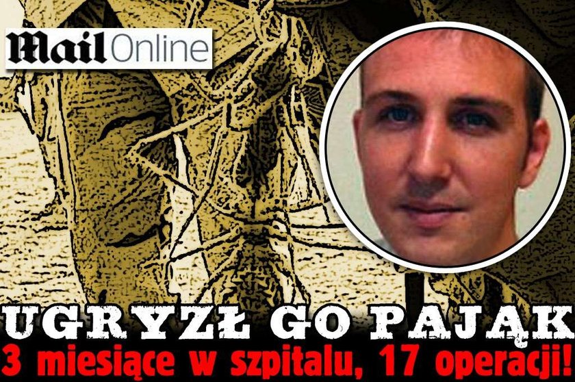 Ugryzł go pająk. 17 operacji, 3 miesiące w szpitalu