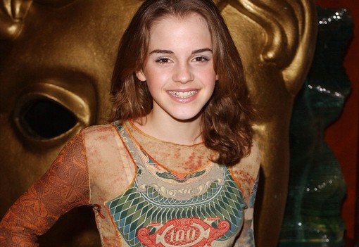 Beleszédülünk, annyit változott Emma Watson haja az elmúlt 23 évben!
