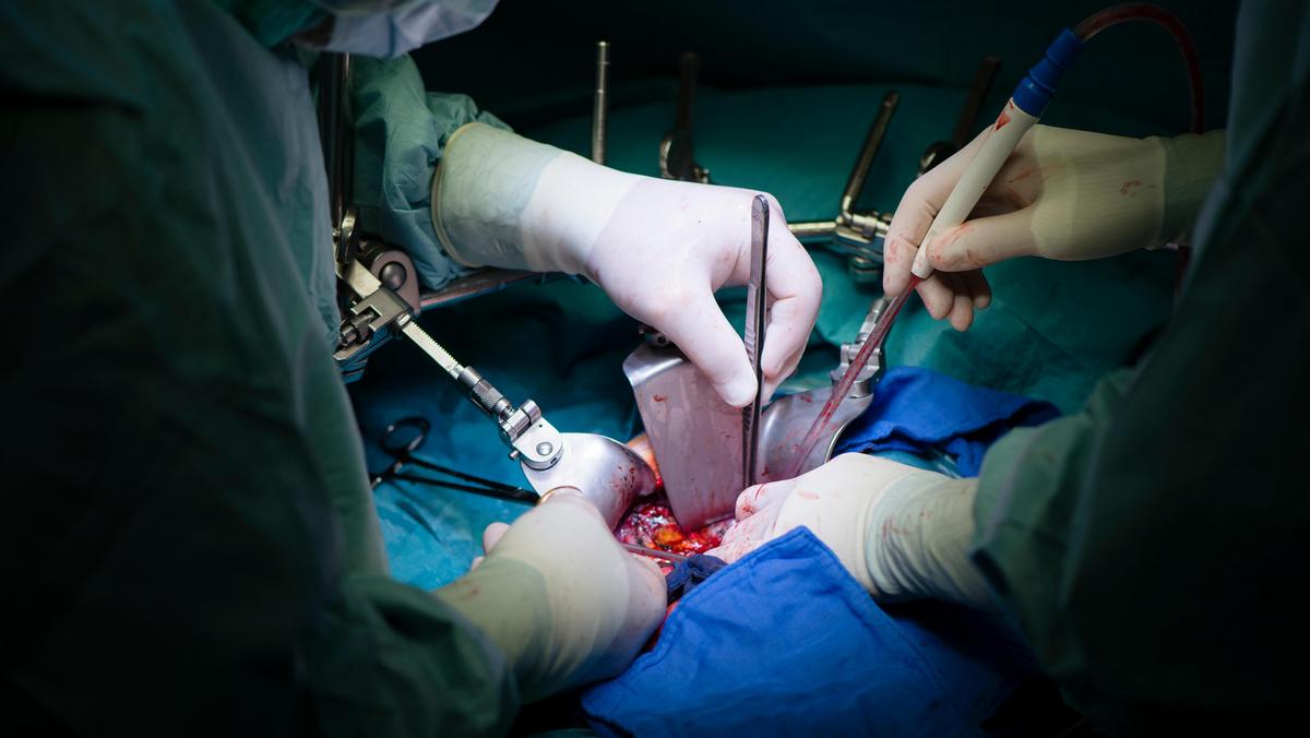 Surgeons transplanting a liver
